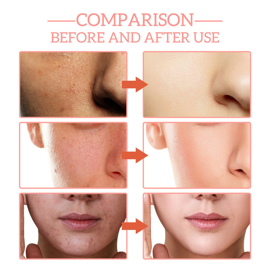 Moisturizing Skin Anti-wrinkle Firming Fade Spots 5-in-1 Facial